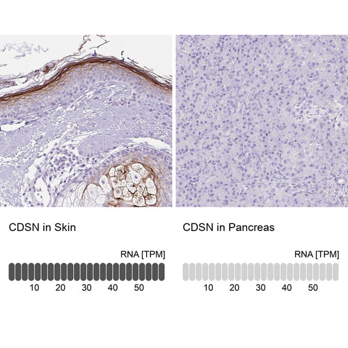 Immunohistochemistry analysis in human skin and pancreas tissues using HPA054184 antibody. Corresponding CDSN RNA-seq data are presented for the same tissues.