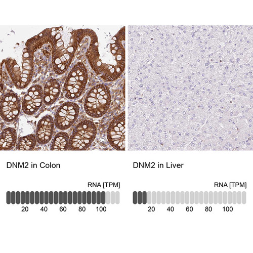 Immunohistochemistry analysis in human colon and liver tissues using HPA054246 antibody. Corresponding DNM2 RNA-seq data are presented for the same tissues.