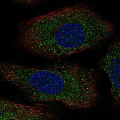 Immunofluorescent staining of human cell line A549 shows localization to cytosol.