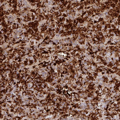Immunohistochemical staining of human spleen shows strong cytoplasmic positivity in cells in red pulp.