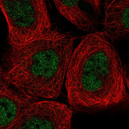 Immunofluorescent staining of human cell line A-431 shows localization to nucleoplasm.