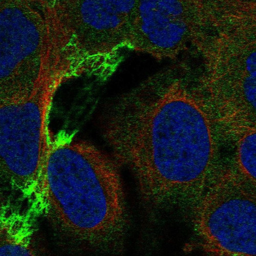 Immunofluorescent staining of human cell line U-2 OS shows localization to plasma membrane & focal adhesion sites.