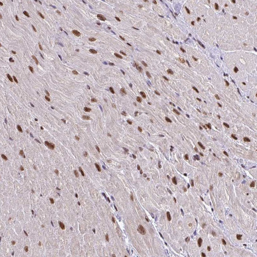 Immunohistochemical staining of human heart muscle shows strong nuclear positivity in myocytes.