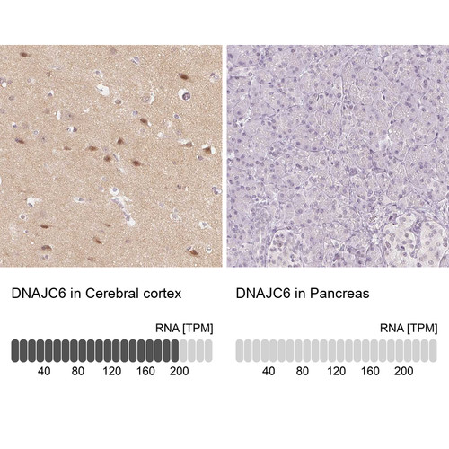 Immunohistochemistry analysis in human cerebral cortex and pancreas tissues using Anti-DNAJC6 antibody. Corresponding DNAJC6 RNA-seq data are presented for the same tissues.