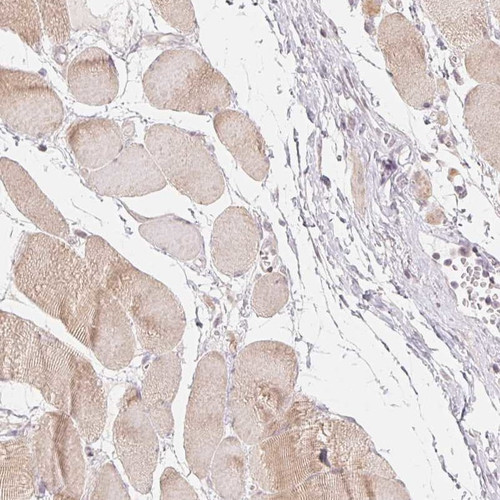 Immunohistochemical staining of human skeletal muscle shows cytoplasmic positivity in myocytes.