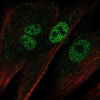 Immunofluorescent staining of human cell line ASC TERT1 shows localization to nucleoplasm.