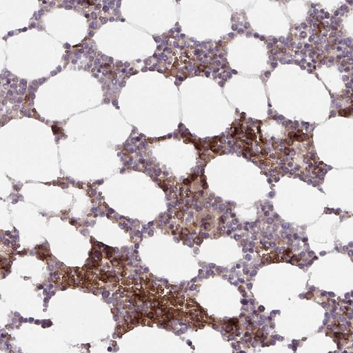 Immunohistochemical staining of human bone marrow shows strong cytoplasmic positivity in hematopoietic cells.