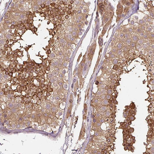 Immunohistochemical staining of human testis shows strong cytoplasmic positivity in cells in seminiferus ducts.