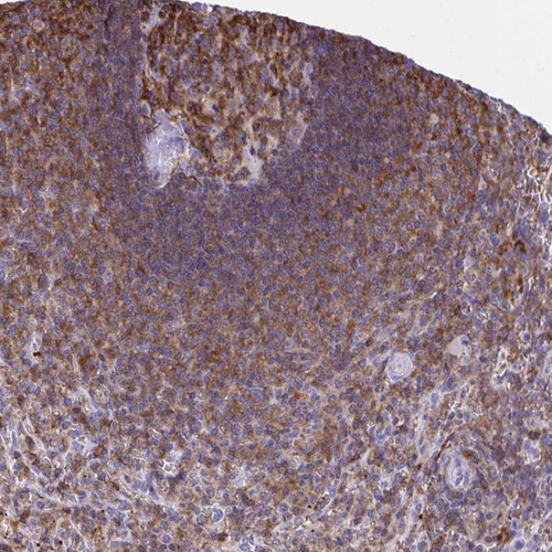 Immunohistochemical staining of human spleen shows strong cytoplasmic positivity in cells in white pulp.