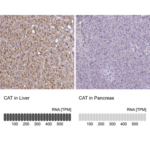 Immunohistochemistry analysis in human liver and pancreas tissues using Anti-CAT antibody. Corresponding CAT RNA-seq data are presented for the same tissues.