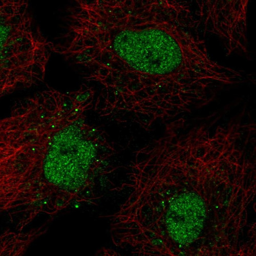 Immunofluorescent staining of human cell line A549 shows localization to nucleoplasm & vesicles.