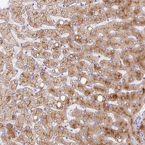 Immunohistochemical staining of human appendix shows positivity in plasma.