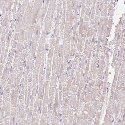 Immunohistochemical staining of human heart muscle shows weak cytoplasmic positivity in myocytes.