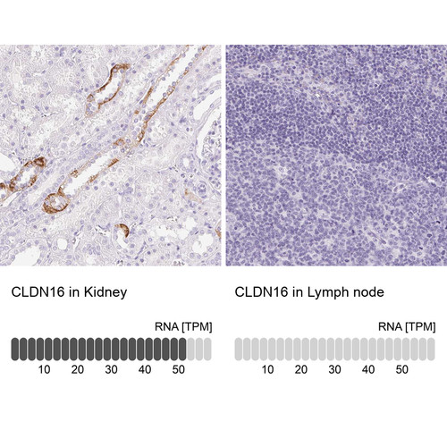 Immunohistochemistry analysis in human kidney and lymph node tissues using Anti-CLDN16 antibody. Corresponding CLDN16 RNA-seq data are presented for the same tissues.
