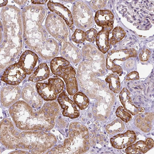 Immunohistochemical staining of human kidney shows strong cytoplasmic positivity in cells in tubules.