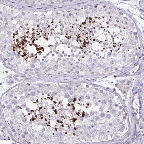 Immunohistochemical staining of human testis shows strong cytoplasmic positivity in acrosomal cap in spermatids.