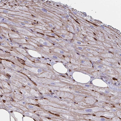 Immunohistochemical staining of human heart muscle shows moderate membranous positivity in myocytes.