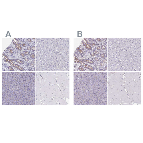 Immunohistochemical staining of human gastrointestinal, liver, pancreas and skeletal muscle using Anti-CHMP5 antibody HPA056437 (A) shows similar protein distribution across tissues to independent antibody HPA042883 (B).