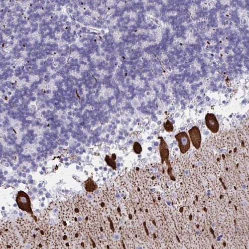 Immunohistochemical staining of human cerebellum shows strong cytoplasmic positivity in Purkinje cells.