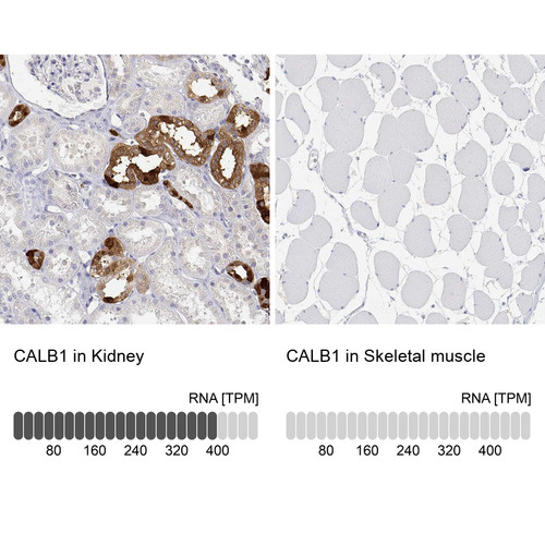Immunohistochemistry analysis in human kidney and skeletal muscle tissues using HPA056734 antibody. Corresponding CALB1 RNA-seq data are presented for the same tissues.