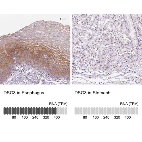 Immunohistochemistry analysis in human esophagus and stomach tissues using Anti-DSG3 antibody. Corresponding DSG3 RNA-seq data are presented for the same tissues.