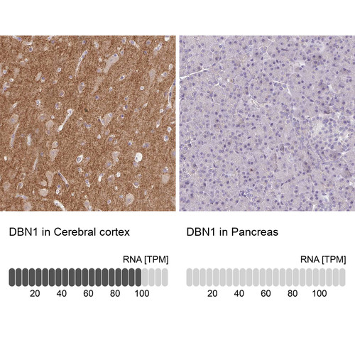 Immunohistochemistry analysis in human cerebral cortex and pancreas tissues using Anti-DBN1 antibody. Corresponding DBN1 RNA-seq data are presented for the same tissues.