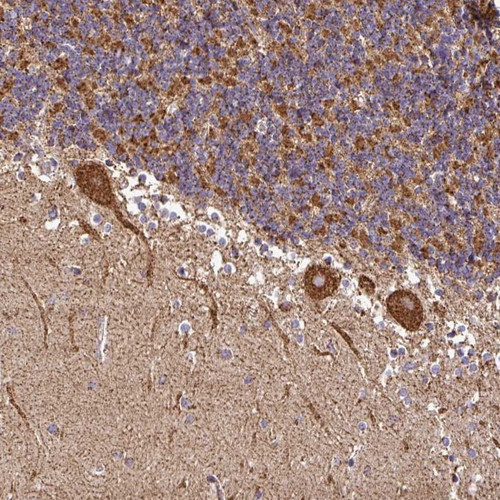 Immunohistochemical staining of human cerebellum shows strong cytoplasmic positivity in Purkinje cells.