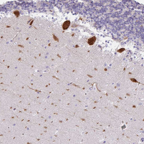 Immunohistochemical staining of human cerebellum shows strong cytoplasmic positivity in Purkinje cells.