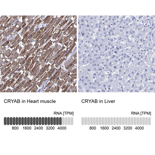 Immunohistochemistry analysis in human heart muscle and liver tissues using HPA057100 antibody. Corresponding CRYAB RNA-seq data are presented for the same tissues.