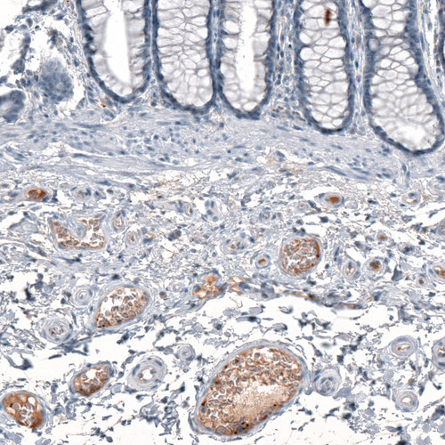 Immunohistochemical staining of human rectum shows moderate positivity in plasma.