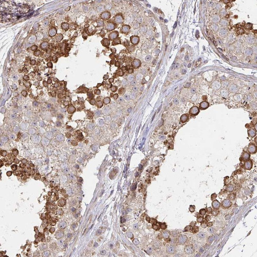 Immunohistochemical staining of human testis shows strong cytoplasmic positivity in cells in seminiferus ducts.
