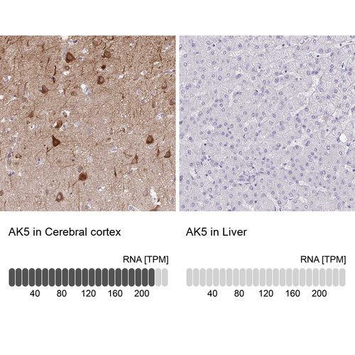 Immunohistochemistry analysis in human cerebral cortex and liver tissues using Anti-AK5 antibody. Corresponding AK5 RNA-seq data are presented for the same tissues.