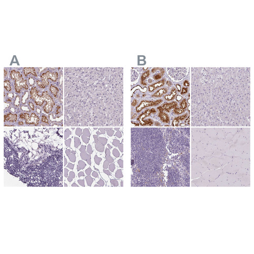 Immunohistochemical staining of human kidney, liver, lymph node and skeletal muscle using Anti-ATP6V1D antibody HPA057316 (A) shows similar protein distribution across tissues to independent antibody HPA031515 (B).