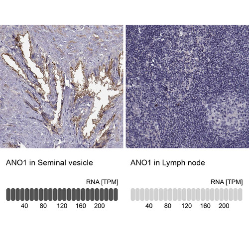Immunohistochemistry analysis in human seminal vesicle and lymph node tissues using Anti-ANO1 antibody. Corresponding ANO1 RNA-seq data are presented for the same tissues.