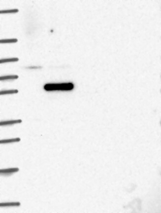 Lane 1: Marker [kDa] 250, 130, 95, 72, 55, 36, 28, 17, 10 | Lane 2: RT4 | Lane 3: U-251 MG | Lane 4: Human Plasma | Lane 5: Liver | Lane 6: Tonsil