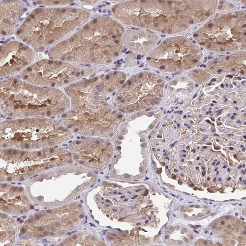 Immunohistochemical staining of human kidney shows moderate cytoplasmic and nuclear positivity in renal tubules.