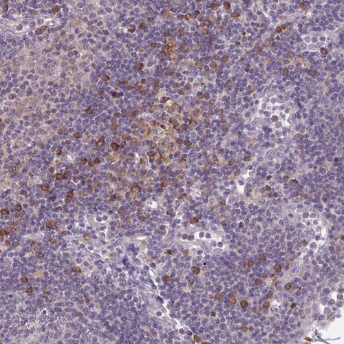Immunohistochemical staining of human lymph node shows moderate cytoplasmic positivity in subset of non-germinal center cells.