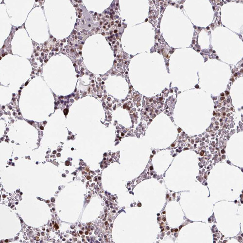 Immunohistochemical staining of human bone marrow shows strong nuclear positivity in hematopoietic cells.