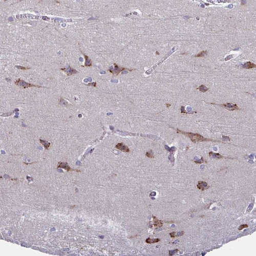 Immunohistochemical staining of human cerebral cortex shows strong cytoplasmic positivity in neuronal cells.