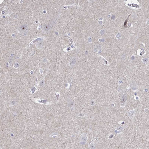 Immunohistochemical staining of human cerebral cortex shows moderate nucleolar positivity in neuronal cells.