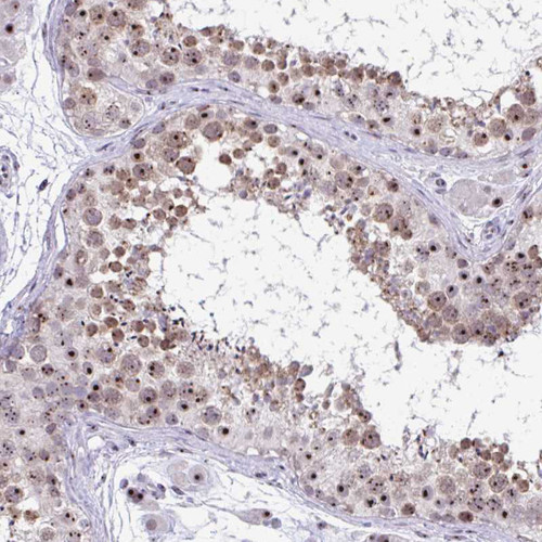 Immunohistochemical staining of human testis shows strong positivity in nucleoli in cells in seminiferous ducts.
