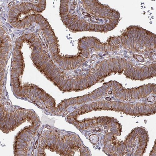 Immunohistochemical staining of human fallopian tube shows moderate  positivity in glandular cells.
