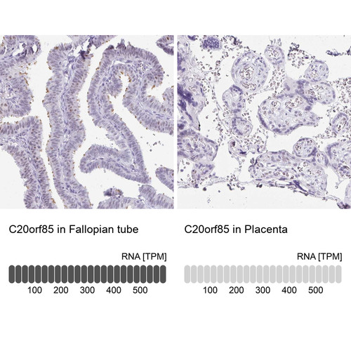 Immunohistochemistry analysis in human fallopian tube and placenta tissues using Anti-C20orf85 antibody. Corresponding C20orf85 RNA-seq data are presented for the same tissues.