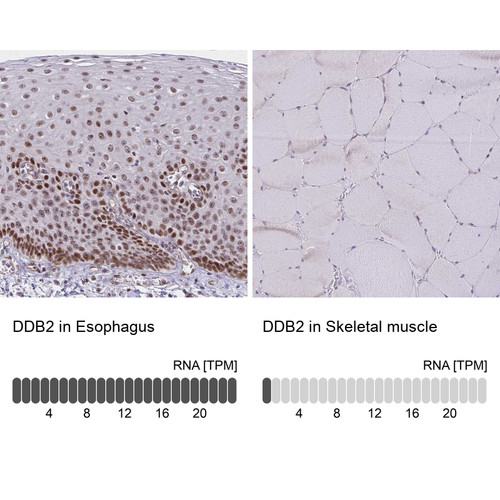 Immunohistochemistry analysis in human esophagus and skeletal muscle tissues using HPA058406 antibody. Corresponding DDB2 RNA-seq data are presented for the same tissues.