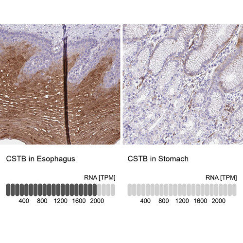 Immunohistochemistry analysis in human esophagus and stomach tissues using Anti-CSTB antibody. Corresponding CSTB RNA-seq data are presented for the same tissues.