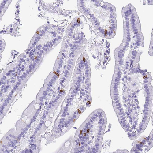 Immunohistochemical staining of human duodenum shows strong membranous positivity in glandular cells.