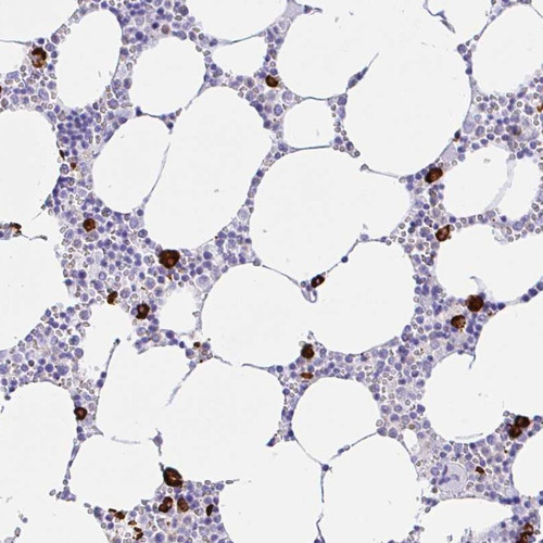 Immunohistochemical staining of human bone marrow shows strong cytoplasmic positivity in hematopoietic cells.