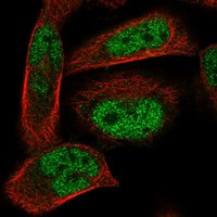 Immunofluorescent staining of human cell line RH-30 shows localization to nucleoplasm.
