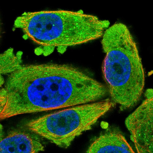 Immunofluorescent staining of human cell line PC-3 shows localization to cytosol.