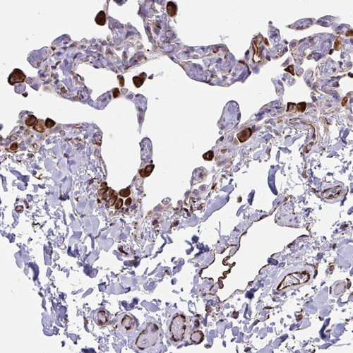 Immunohistochemical staining of human lung shows strong cytoplasmic positivity in macrophages and endothelial cells.
